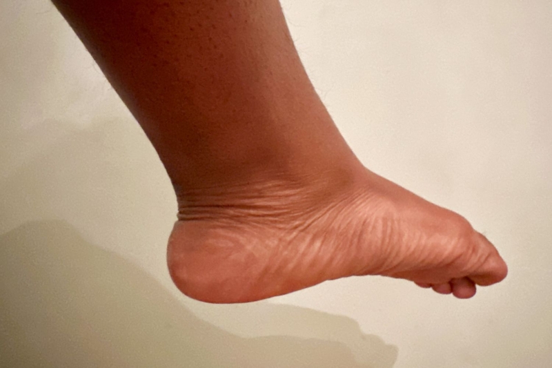 If you’re hard on your feet, chances are it shows as dry skin, cracked heels, or hardened calluses. To revive rough feet, a foot peel or mask is an easy, low effort way to get ready for summer sandals. These InStyle editor-tested picks are proven to make feet smooth, soft, and—dare we say it—sexy.